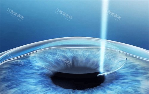 河南省人民医院眼科挂号网上预约挂号-河南省人民医院眼科电话/微信预约