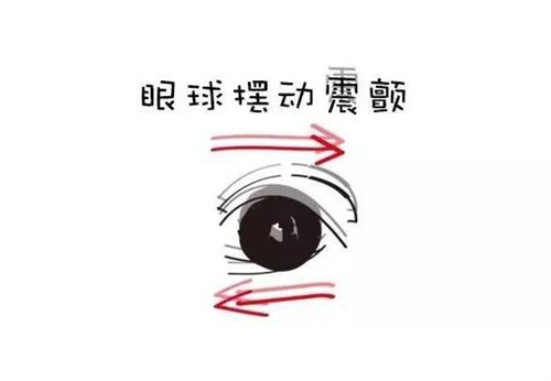 王乐今做眼球震颤价格高不高？一点不高，儿童单眼2w+双眼4w+成人单眼2.5w+双眼5w+