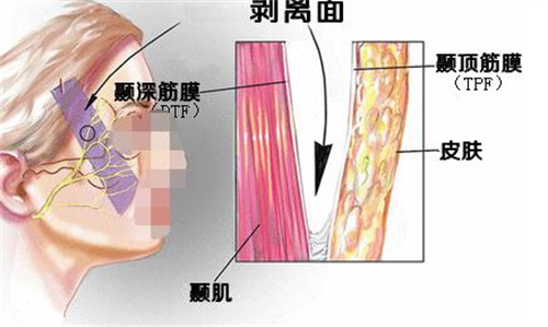 面部皮肤改善层次