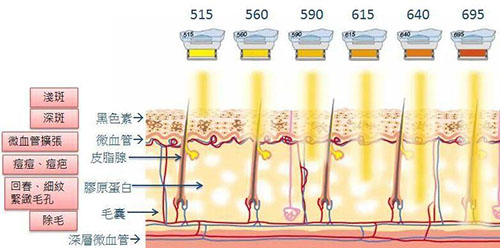 光子嫩肤原理图